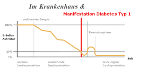 Mehr über den Artikel erfahren Im Krankenhaus (1): Diabetes Manifestation